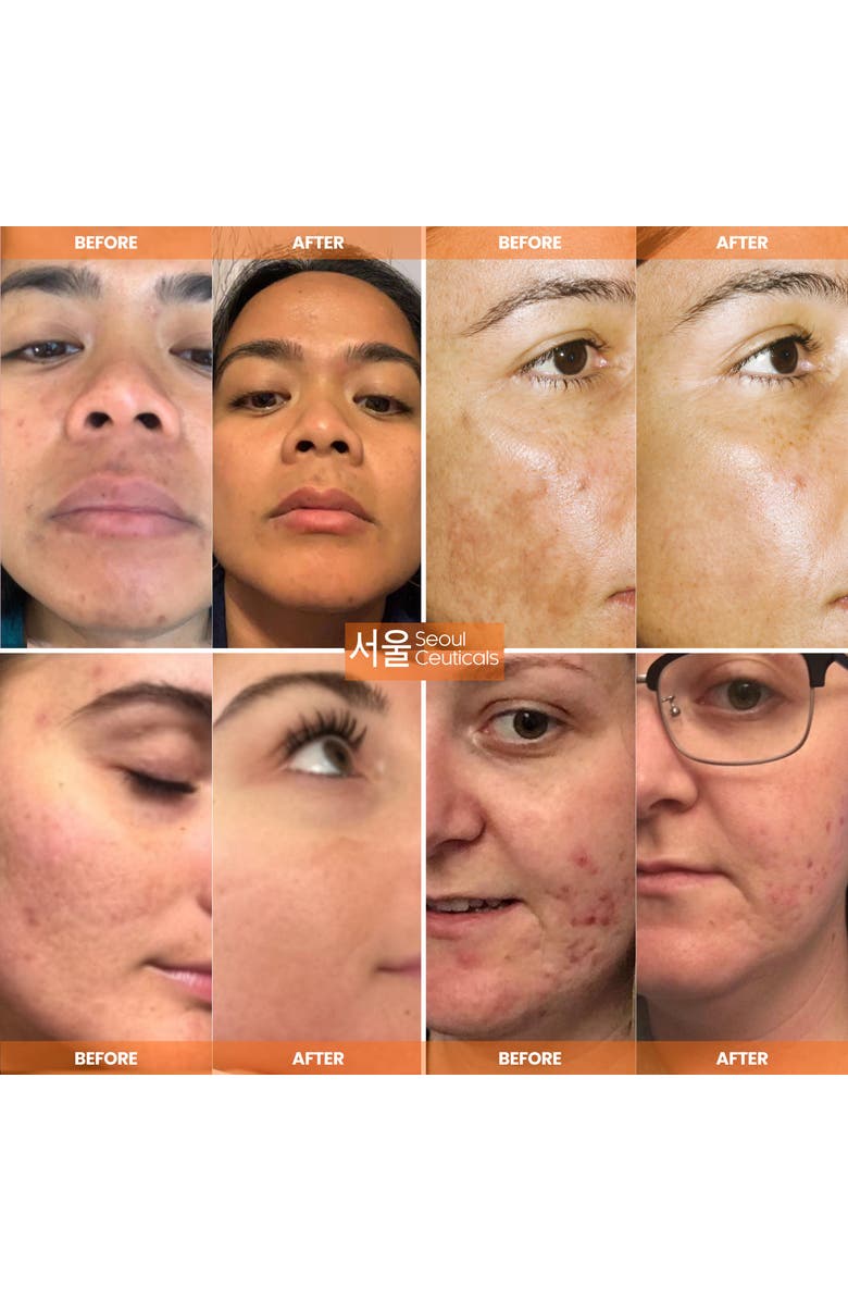 Seoul Ceuticals Korean Skincare Day Glow Vitamin C Serum K Beauty Skincare, Alternate, color, Clear