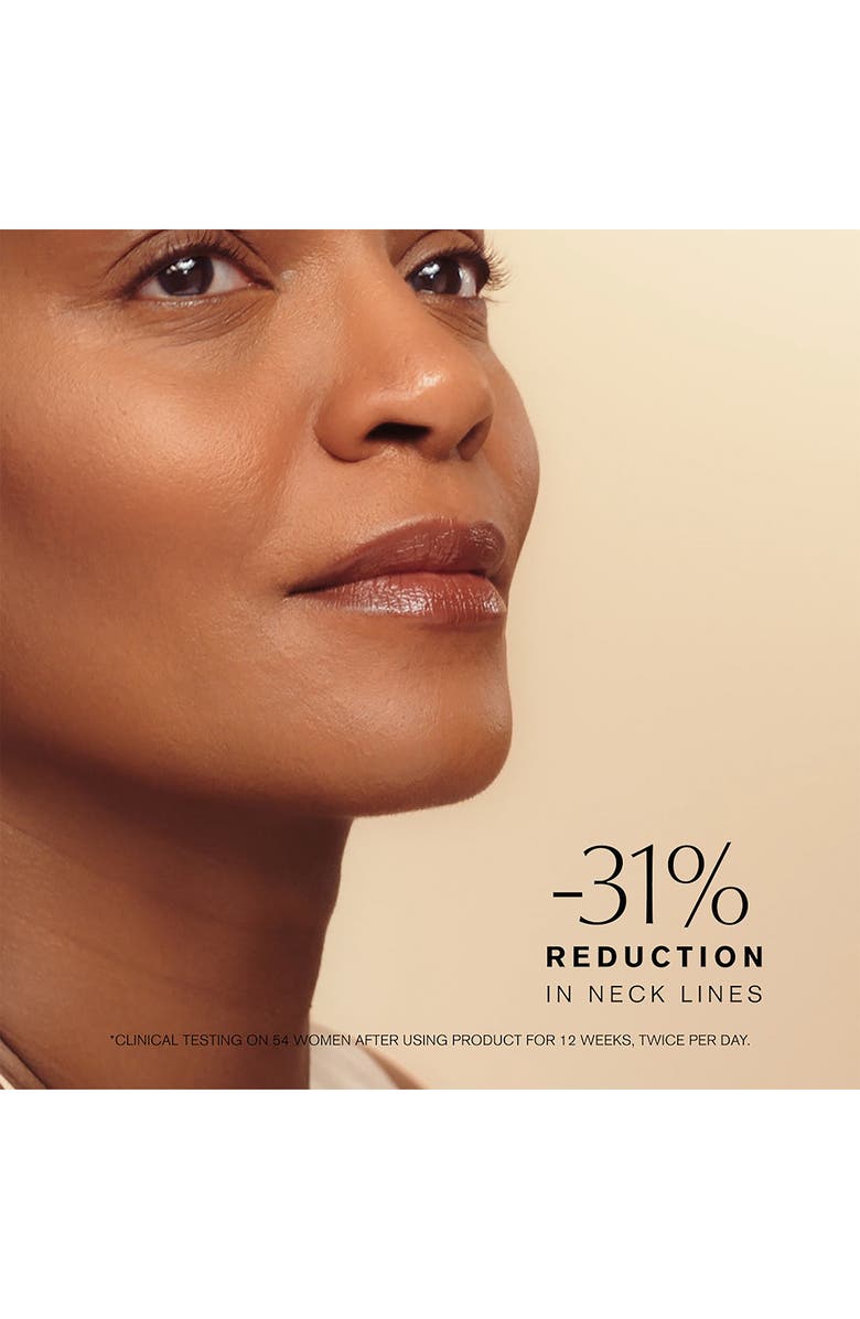 Estée Lauder Revitalizing Supreme+ Youth Power Cream Moisturizer with Hyaluronic Acid & Peptides SPF 25, Alternate, color,