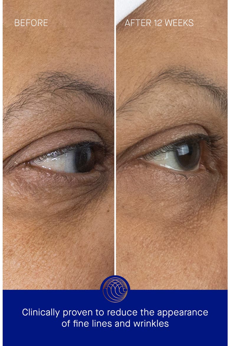 The Eye Cream, Alternate, color, Regular