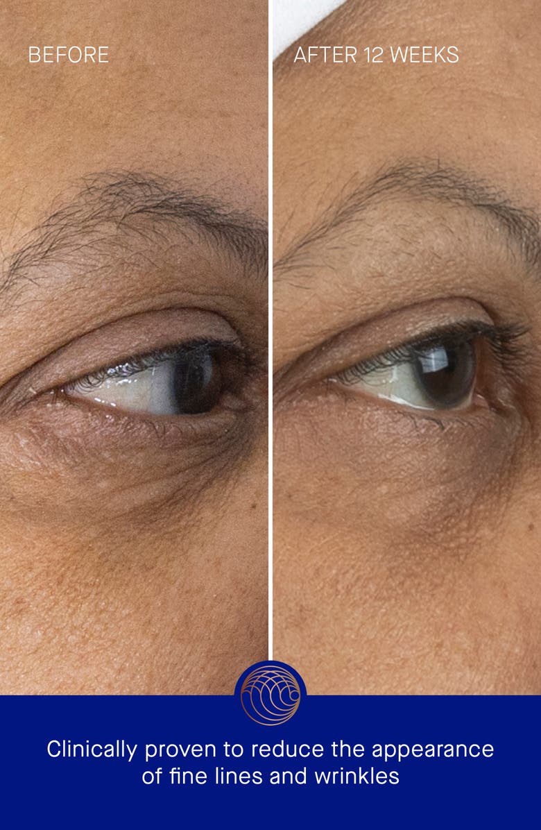 Augustinus Bader The Eye Cream, Alternate, color, Regular