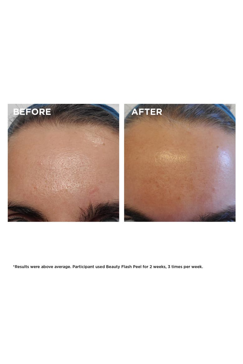 Beauty Flash Peel with BHA & AHA, Alternate, color, NO COLOR