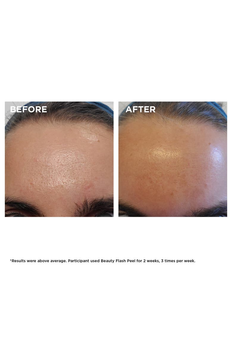 Clarins Beauty Flash Peel with BHA & AHA, Alternate, color,