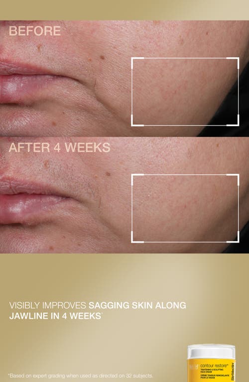 Strivectin ® Counter & Tighten Set In Transparent