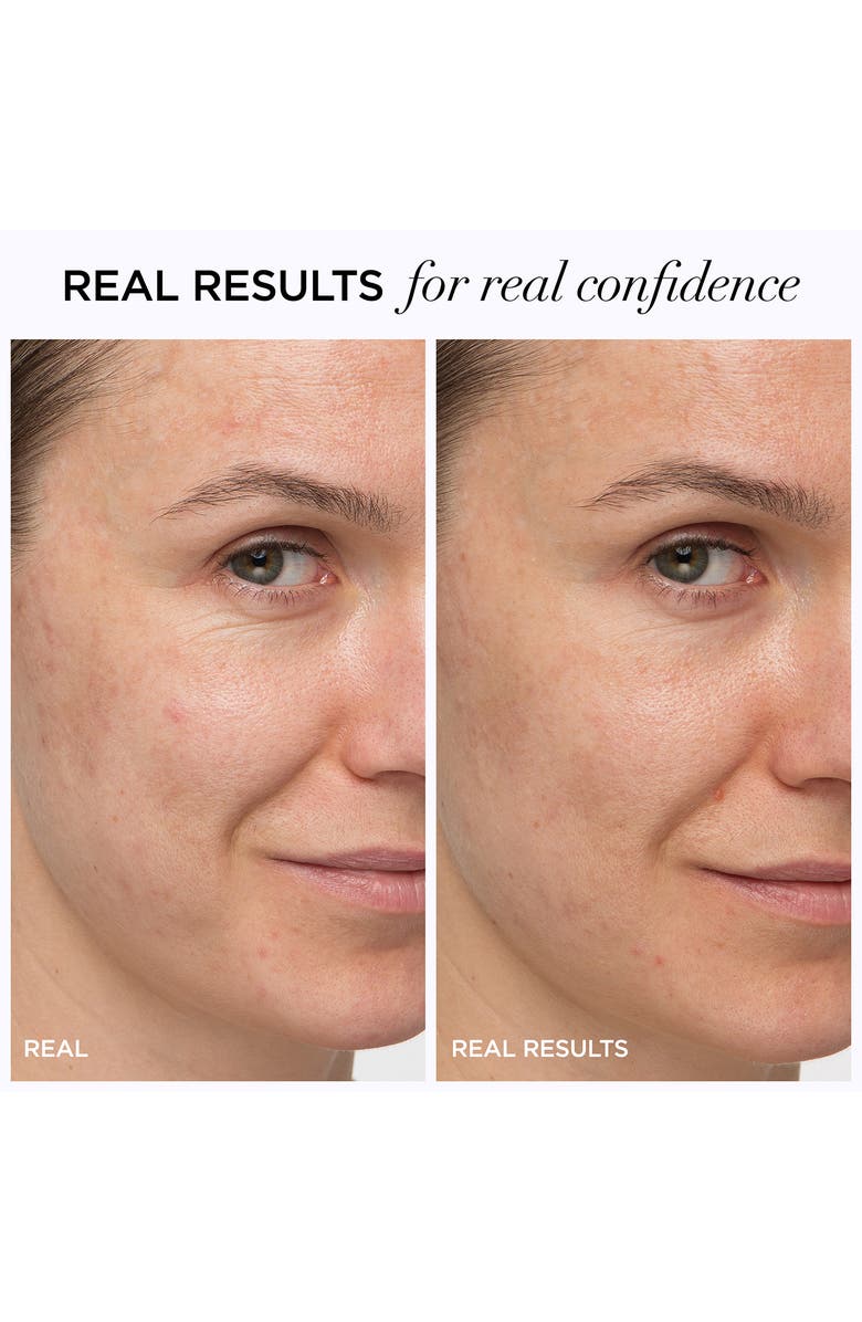 IT Cosmetics Confidence in a Cream Anti-Aging Hydrating Moisturizer, Alternate, color, 