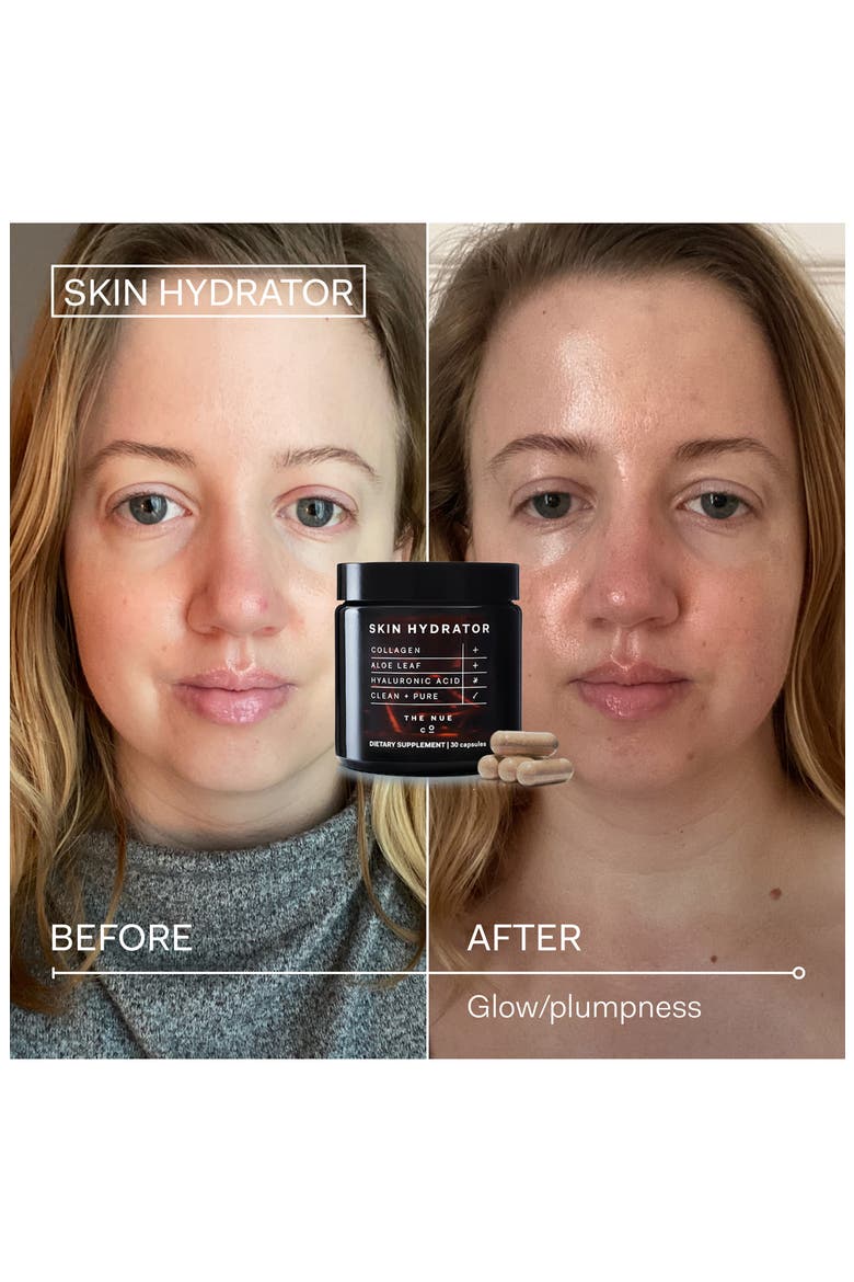Skin Hydrator Dietary Supplement, Alternate, color, NO COLOR