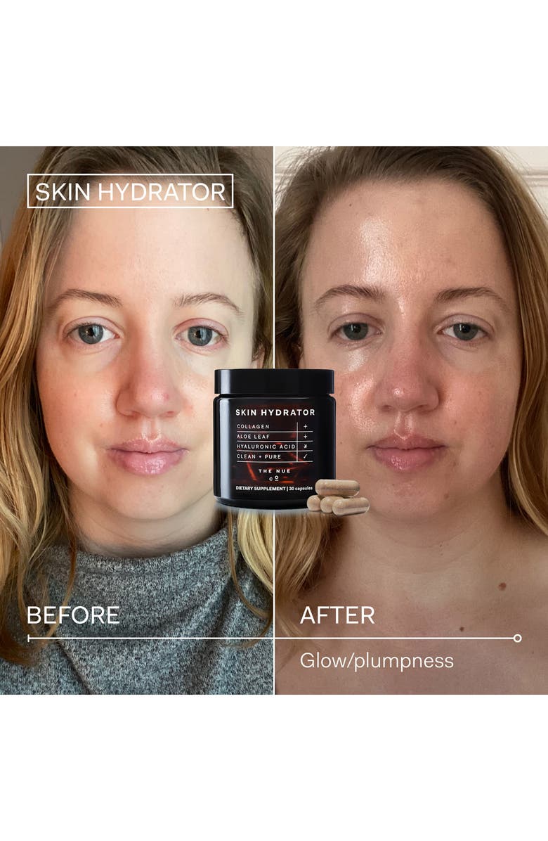 The Nue Co Skin Hydrator Dietary Supplement, Alternate, color, 