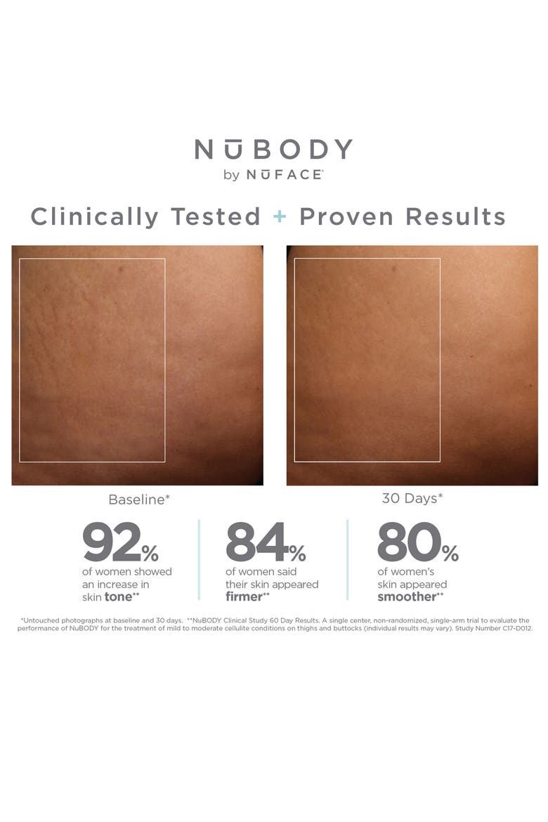 NuBODY Skin Toning Device Set, Alternate, color, NO COLOR
