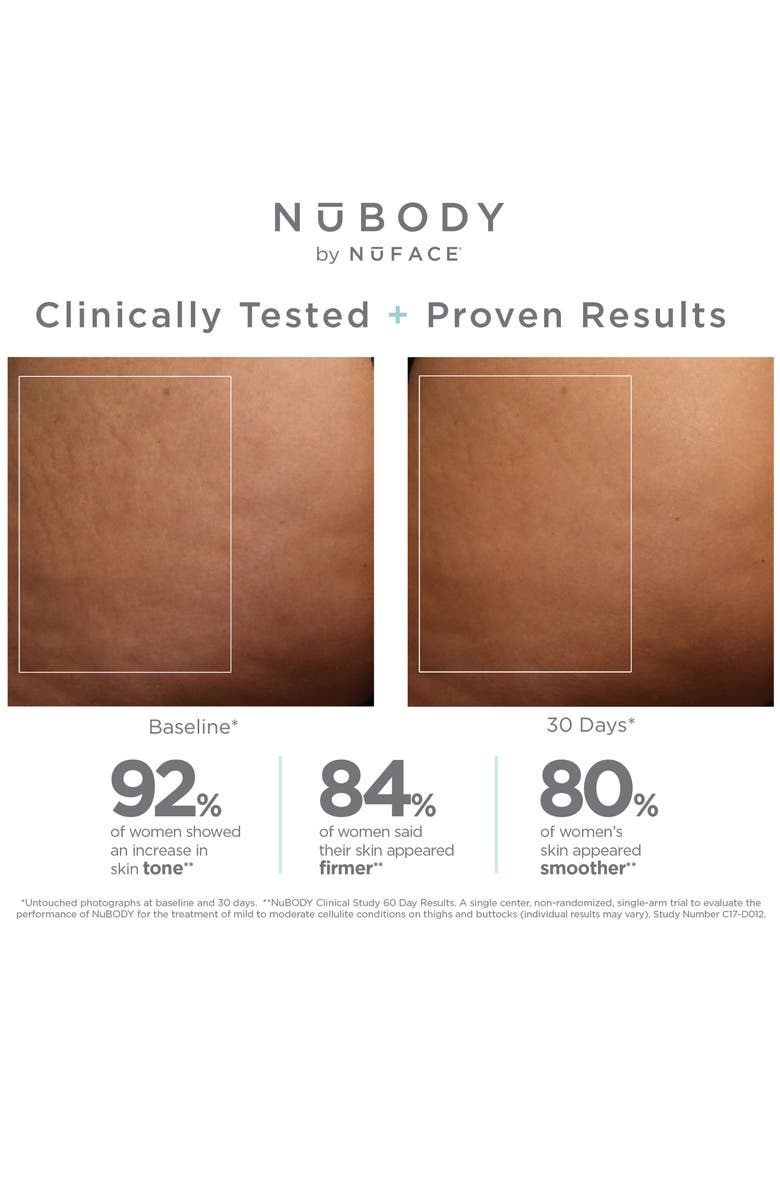 NuFACE<sup>®</sup> NuBODY Skin Toning Device Set, Alternate, color,