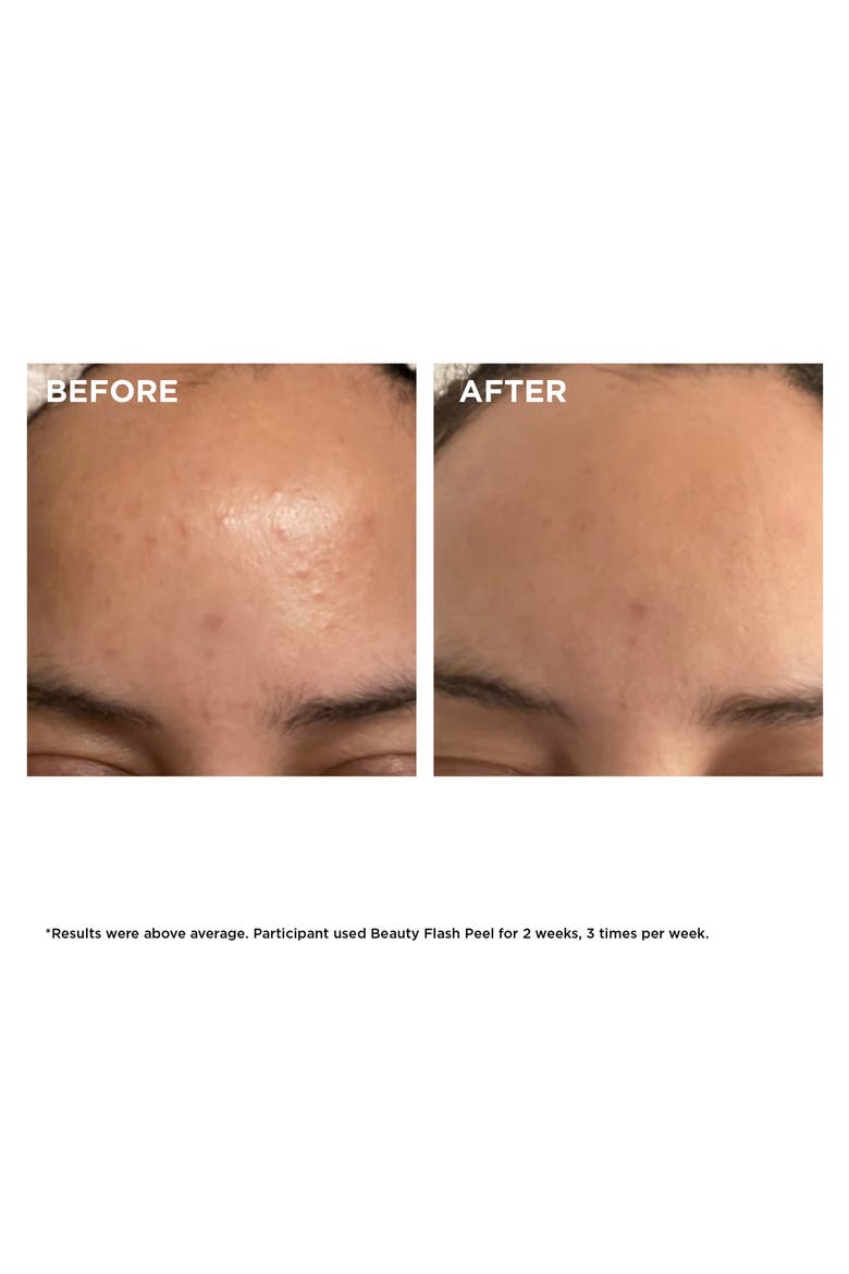 Beauty Flash Peel with BHA & AHA, Alternate, color, NO COLOR