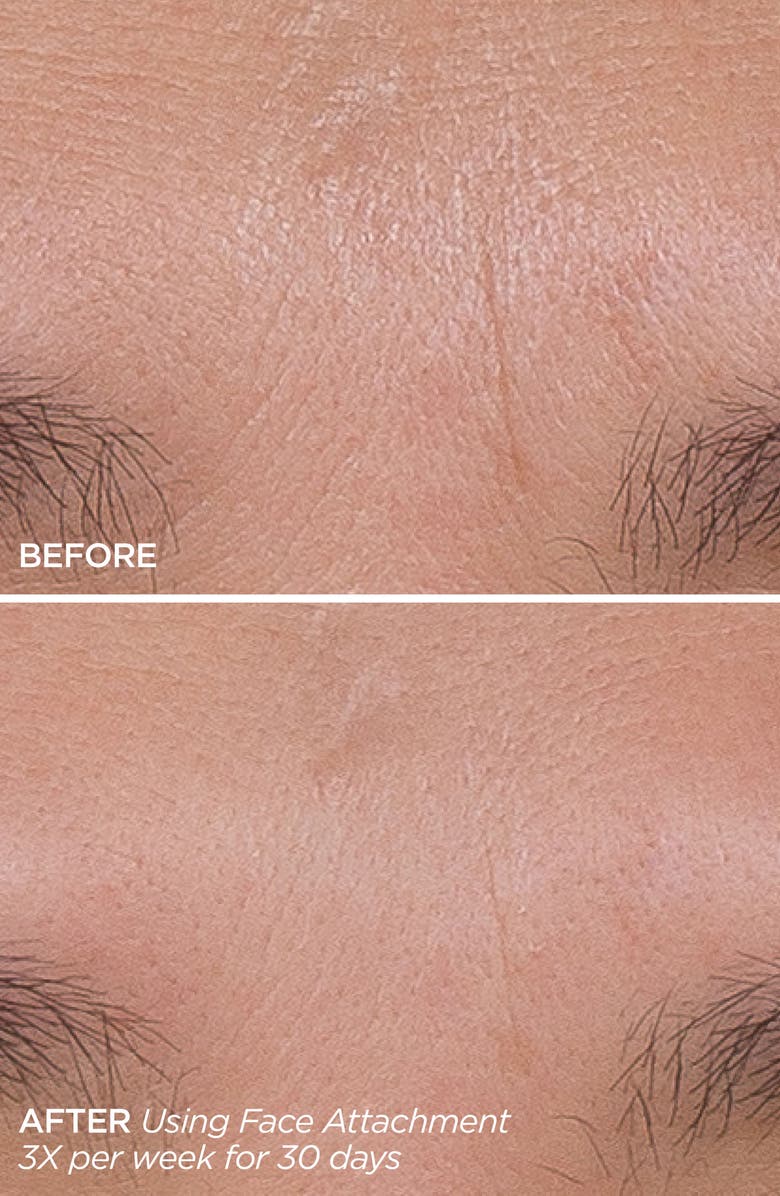 BeautyBio Get That Glow GloPRO<sup>®</sup> Facial Microneedling Discovery Set $233 Value, Alternate, color, 