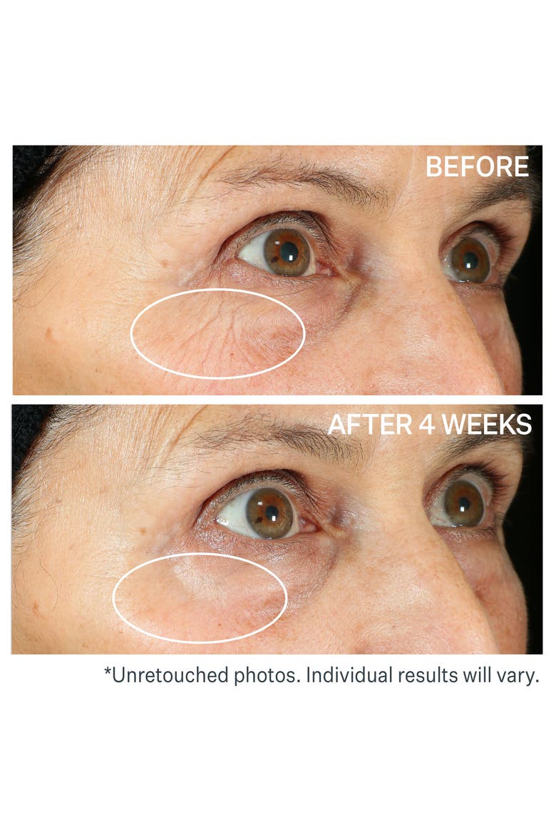 360° Tightening Eye Serum, Alternate, color, NO COLOR