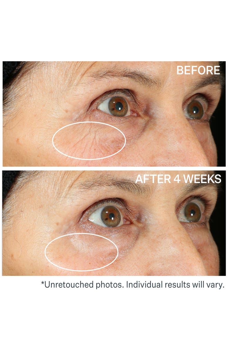 StriVectin<sup>®</sup> 360° Tightening Eye Serum, Alternate, color,