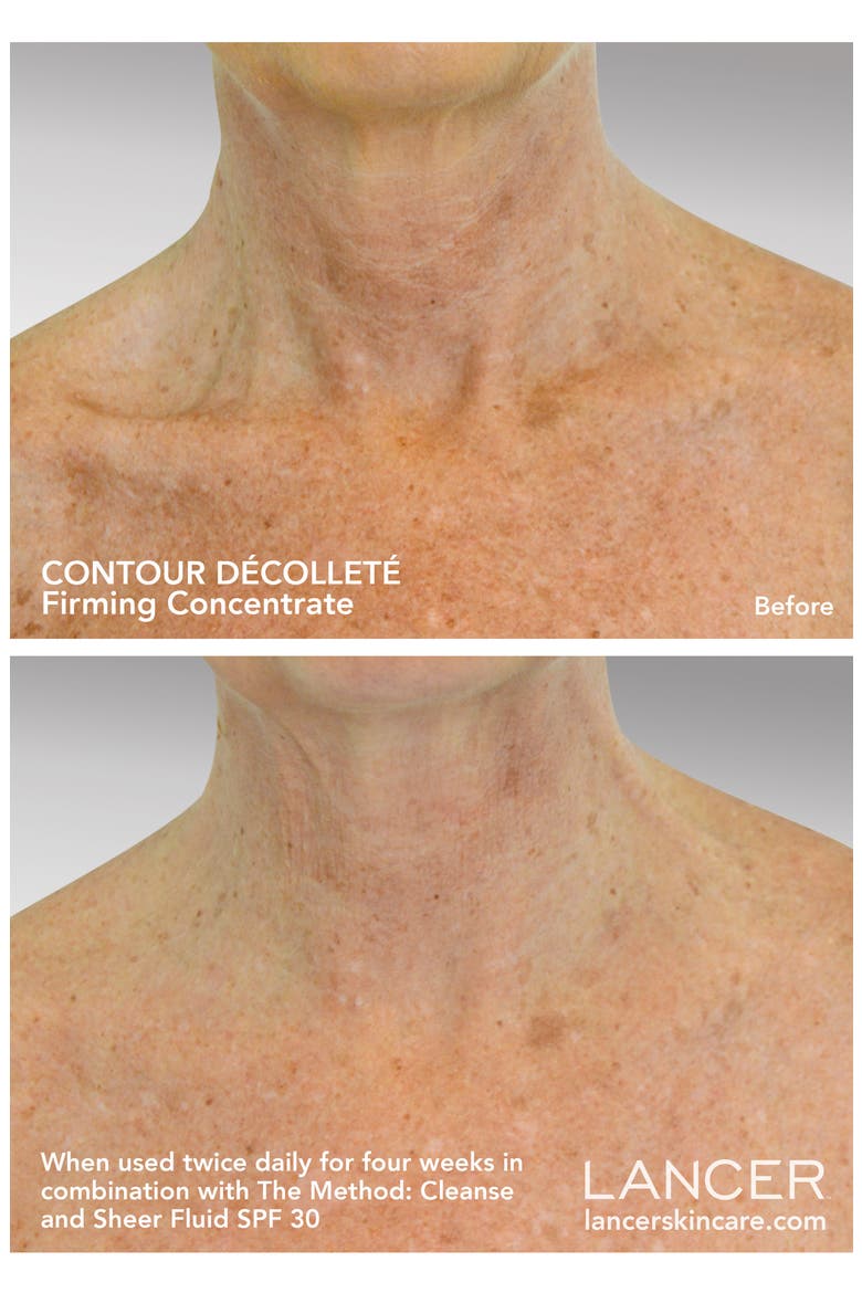 Contour Décolleté Firming Concentrate, Alternate, color, NO COLOR