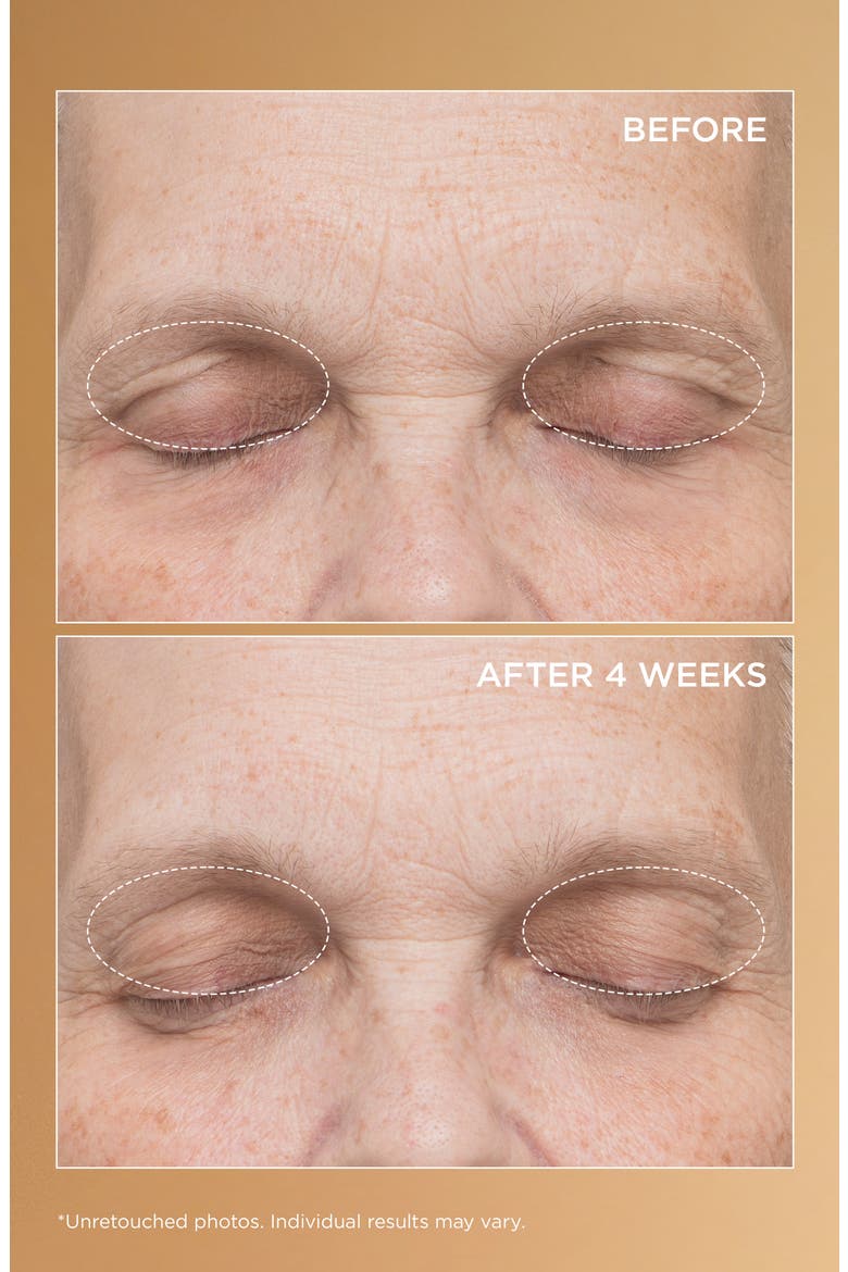 Neuropeptide Eyelid Lift Serum, Alternate, color, NO COLOR
