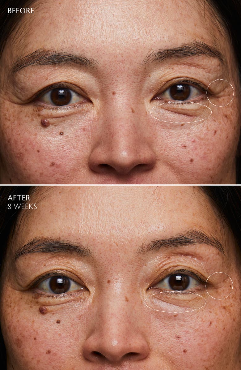 Clé de Peau Beauté Enhancing Eye Contour Cream Supreme, Alternate, color, 