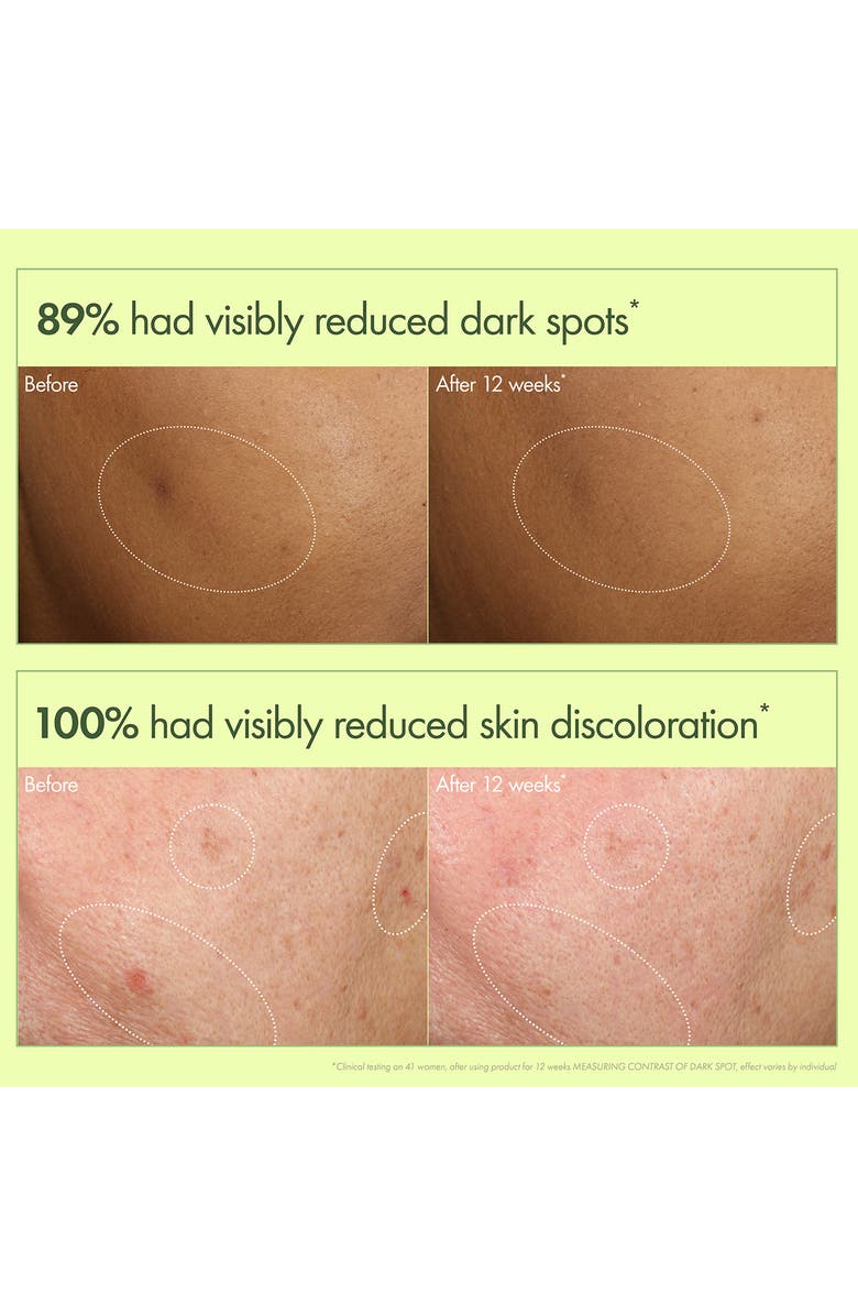 Origins Mega-Mushroom Dark Spot Brightening Face Serum, Alternate, color, 