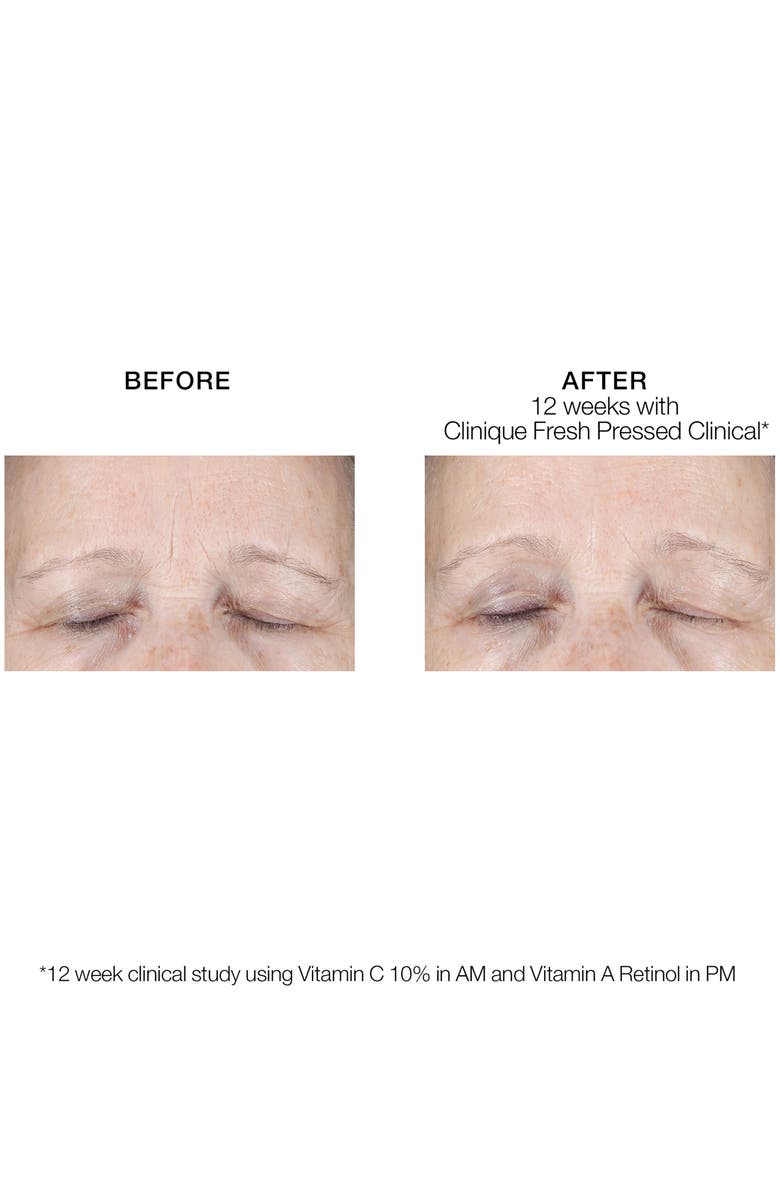 Clinique Fresh Pressed Clinical Daily + Overnight Boosters, Alternate, color, 