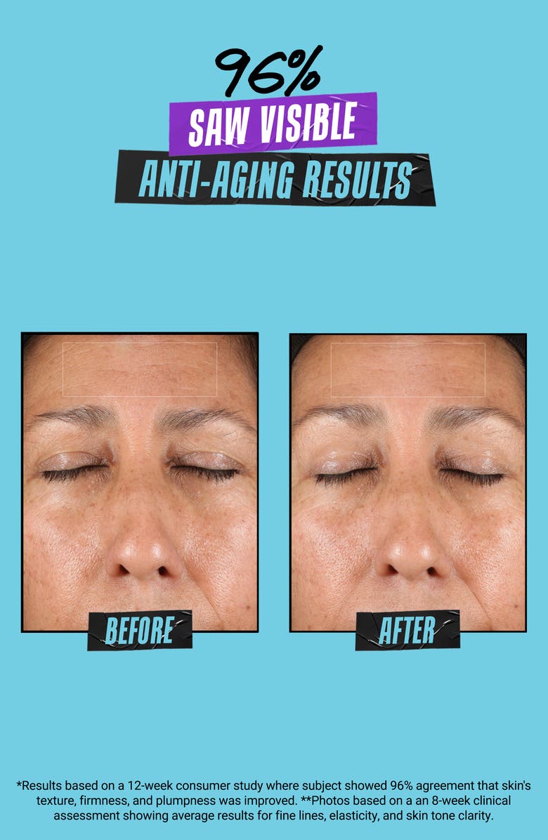 Kiehl's Since 1851 Super Multi-Corrective Soft Cream, Alternate, color,