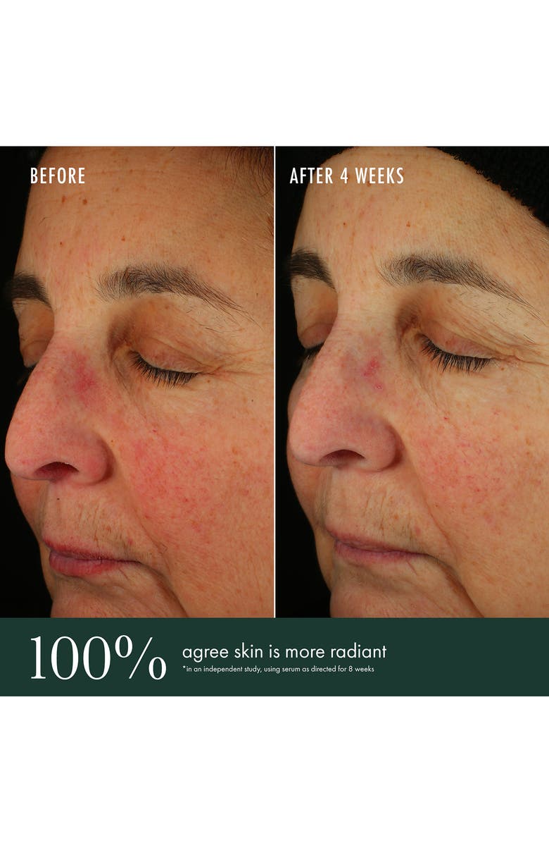 RéVive<sup>®</sup> Brightening Serum Vitamin C, Niacinamide + Bio-Renewal Peptide, Alternate, color, 