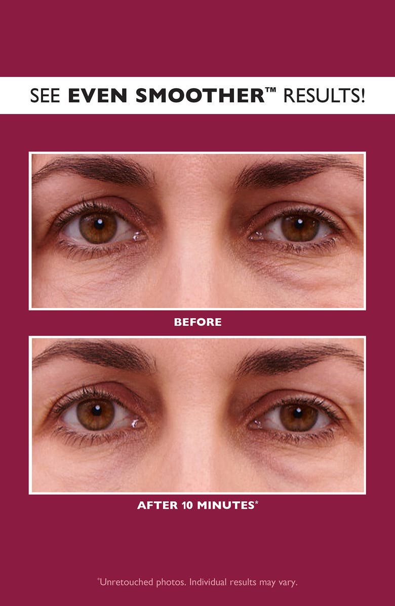 Peter Thomas Roth Even Smoother Glycolic Retinol Hydra-Gel Eye Patches, Alternate, color, 