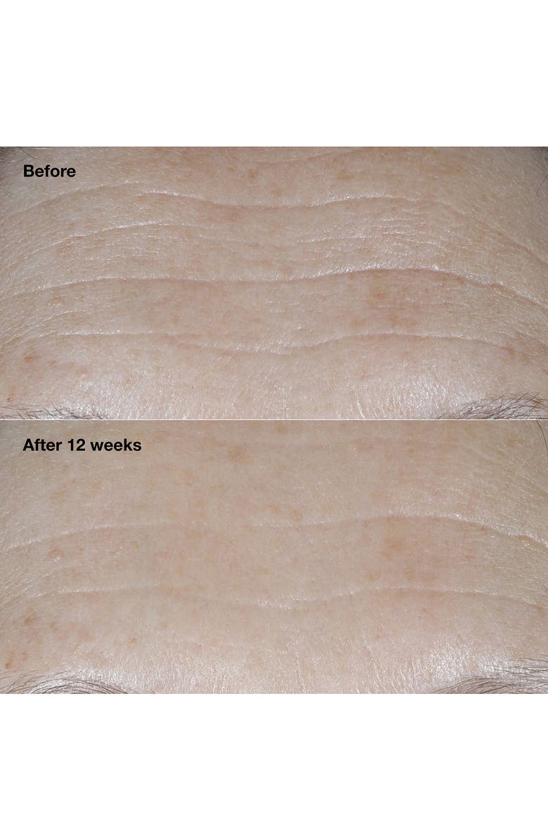 Clinique Smart Clinical Repair Broad Spectrum SPF 30 Wrinkle Correcting Face Cream, Alternate, color,