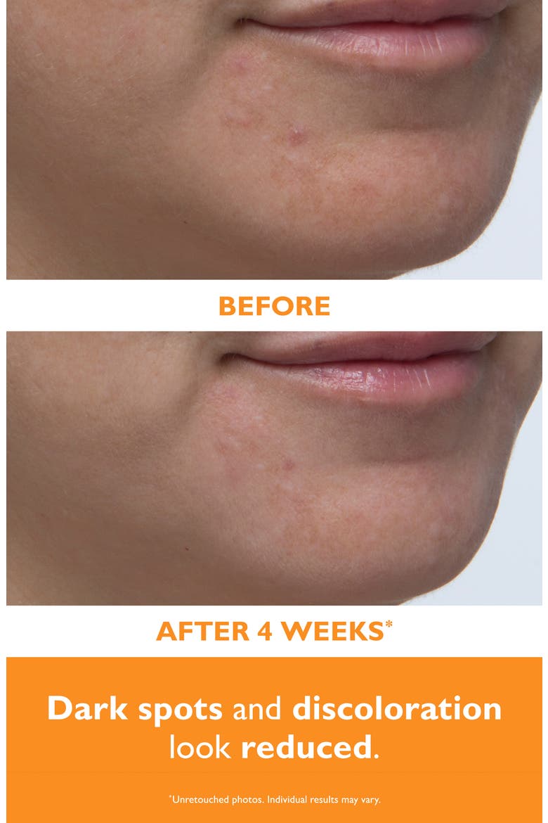 Potent-C™ Power Serum, Alternate, color, NO COLOR