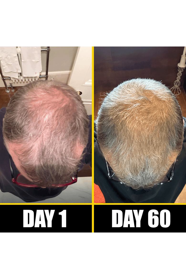 Boost Hair & Beard Growth Strengthening Serum With Biotin & Rosemary, Alternate, color, Brown