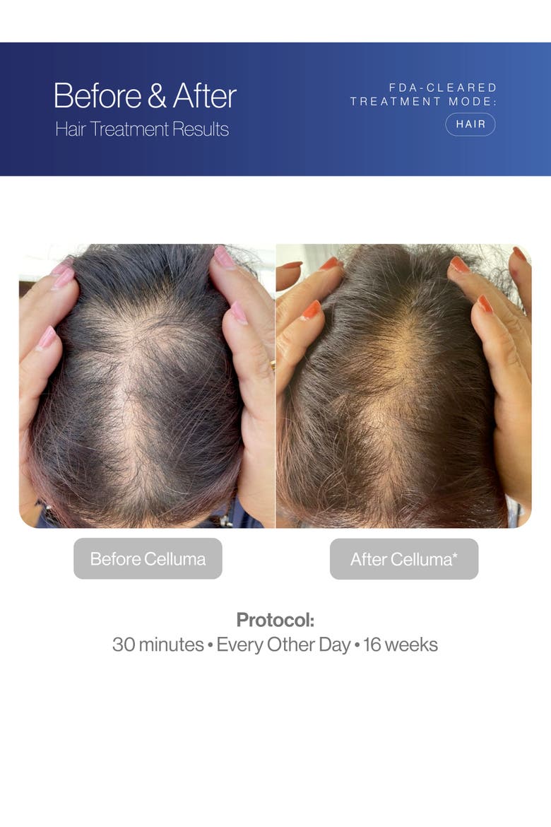 RESTORE Hair System, Alternate, color, Blue