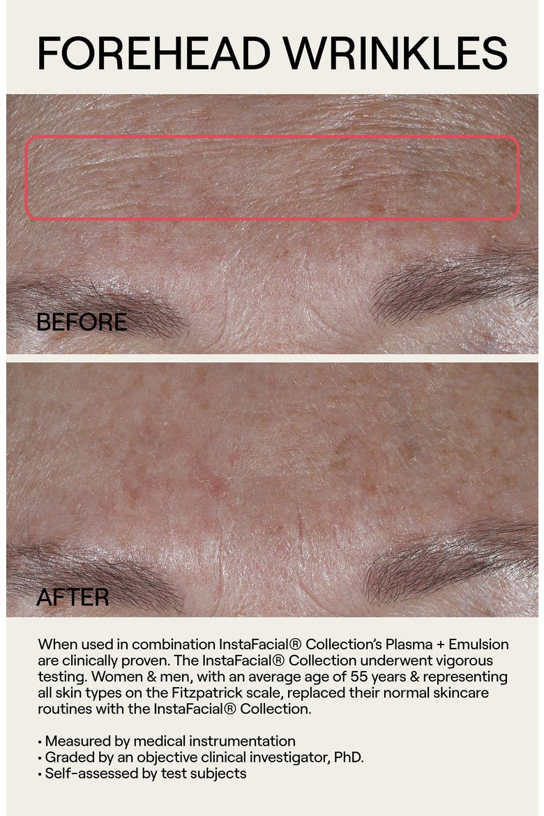 Instafacial® Plasma Bioactive Growth Factor Serum, Alternate, color, NO COLOR