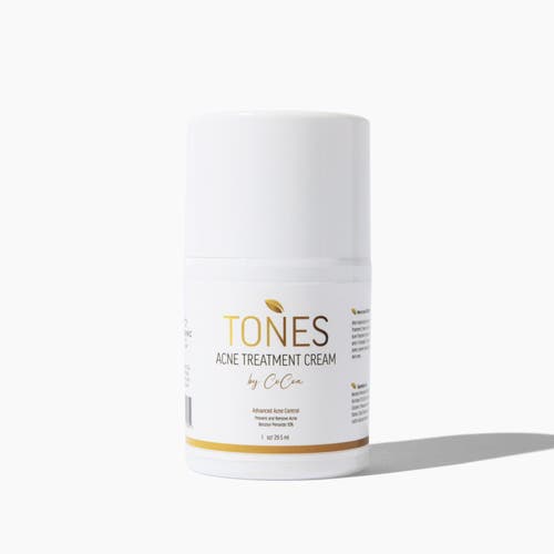 Tones By Cocoa Acne Treatment Cream 29.5 ml In White