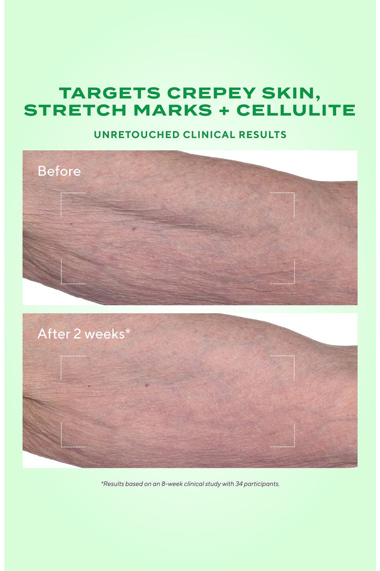 Retinal ReSculpt Body Treatment, Alternate, color, NO COLOR