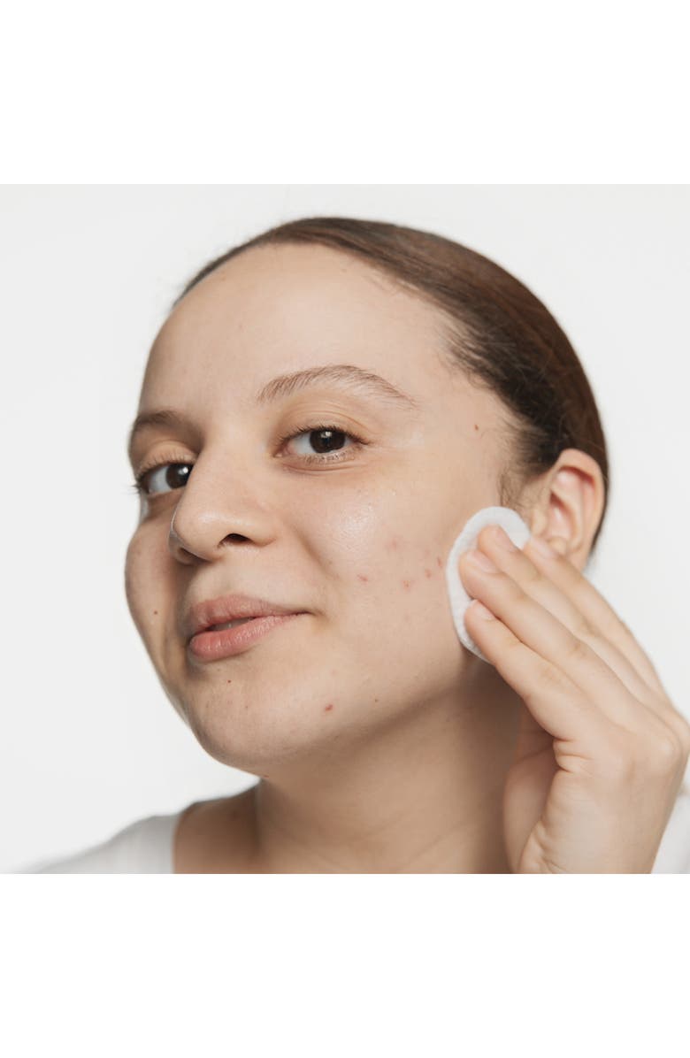 Clinique Acne Solutions Clarifying Face Lotion, Alternate, color, 