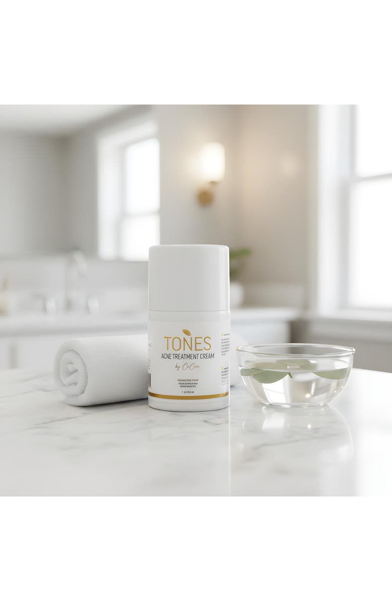 TONES by Cocoa Acne Treatment Cream with Benzoyl Peroxide 29.5ml, Alternate, color, 