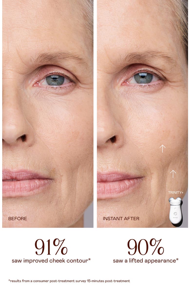 TRINITY+ Starter Kit – Lift & Tighten Facial Microcurrent Device, Alternate, color, NO COLOR