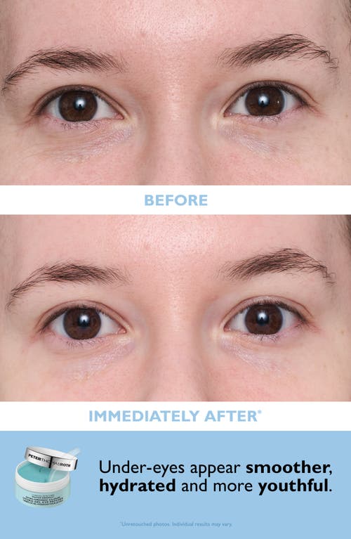 Peter Thomas Roth Patch + Go Eye Patch Set In Transparent