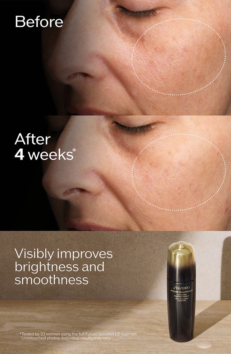 Shiseido Future Solution LX Concentrated Brightening Softener, Alternate, color, Regular