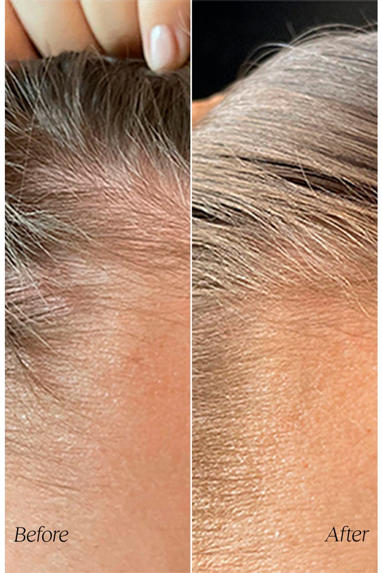 Follicle Boost Hair Density Serum 50ml, Alternate, color, none