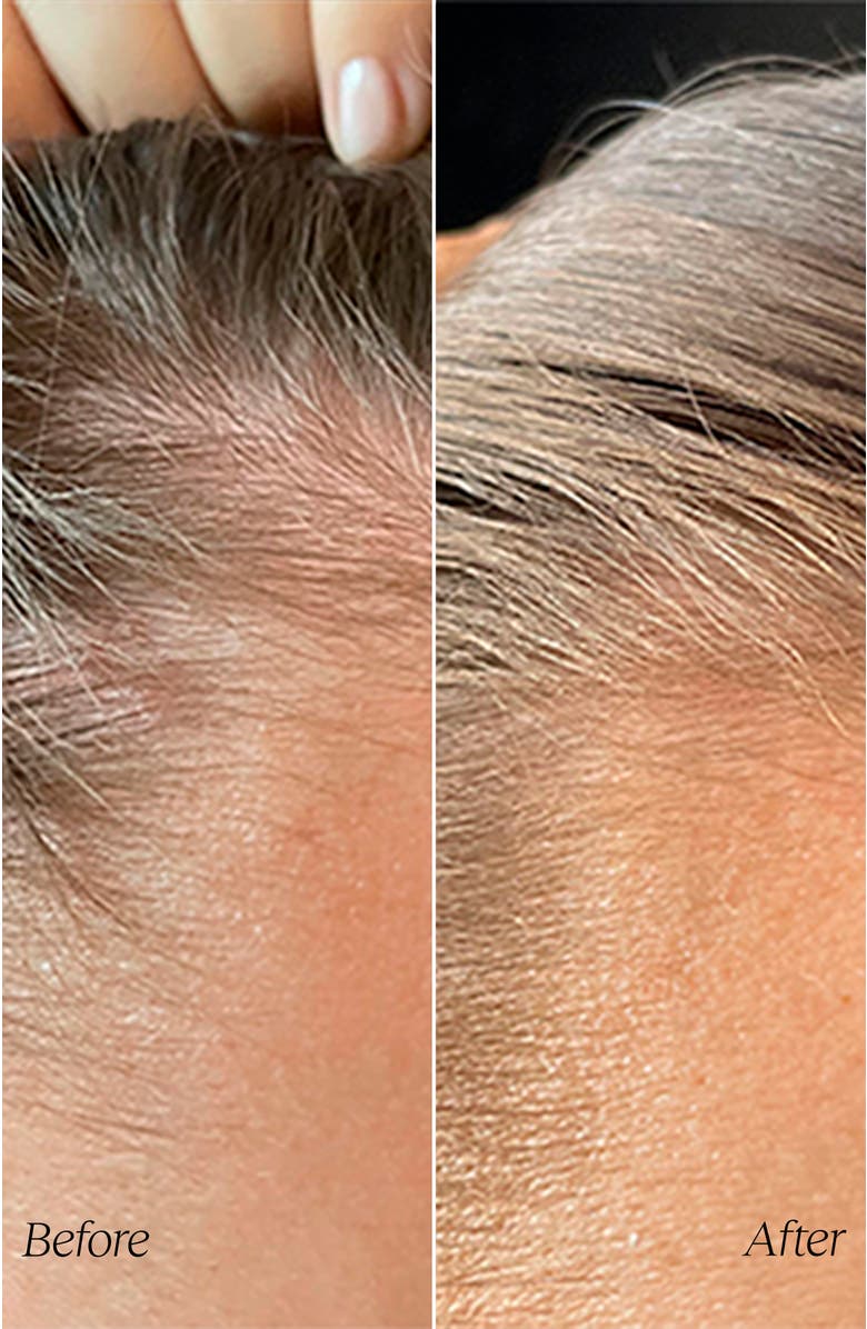 MONPURE Follicle Boost Hair Density Serum 50ml, Alternate, color, NO COLOR