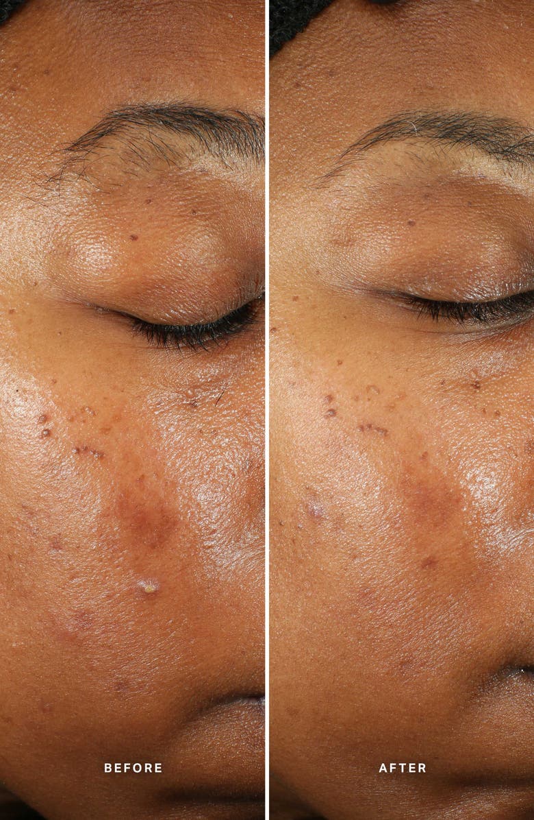 Alpha-H Generation Glow Daily Resurfacing Essence, Alternate, color, 