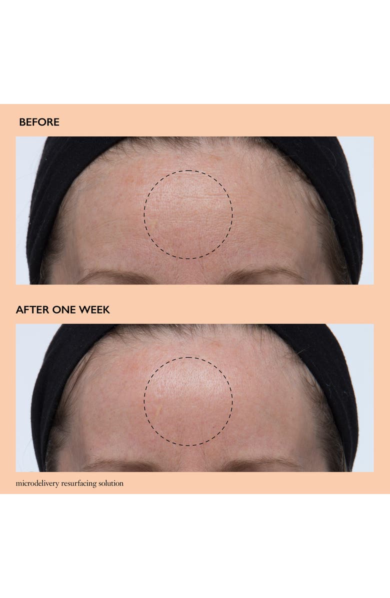 philosophy microdelivery resurfacing solution, Alternate, color,