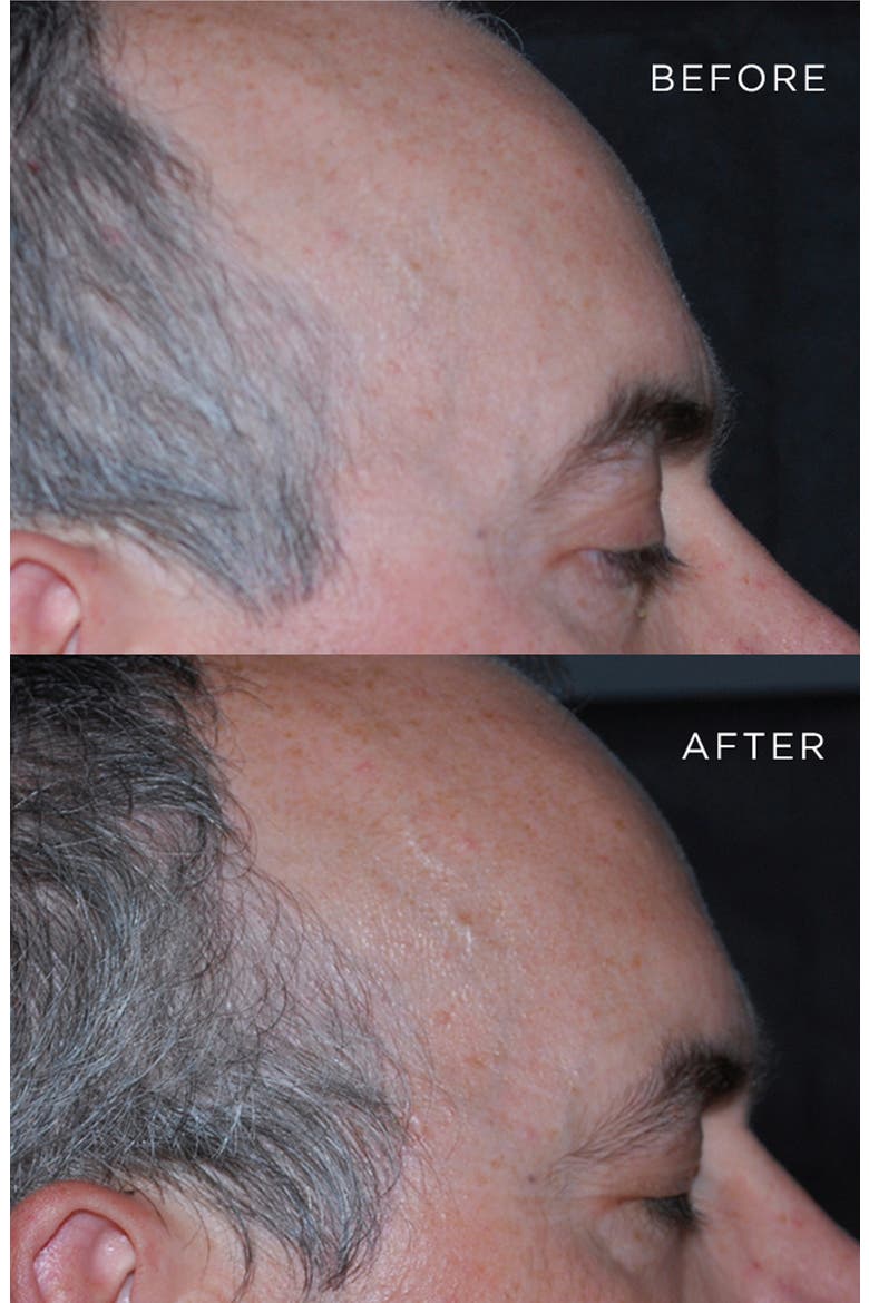 RE30 Anti-Grey Hair Treatment, Alternate, color, NO COLOR