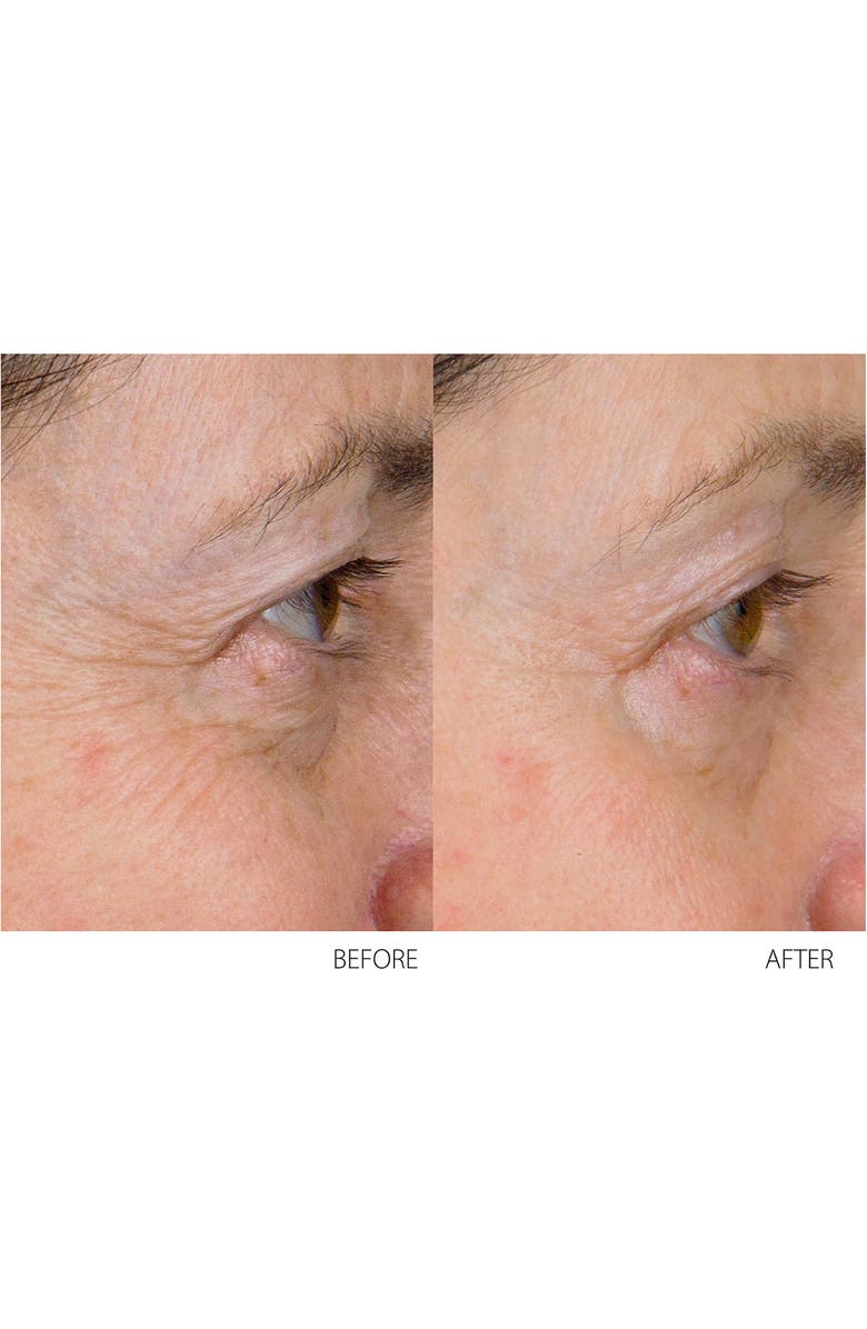 Conture Kinetic Skin Toning System, Alternate, color, 