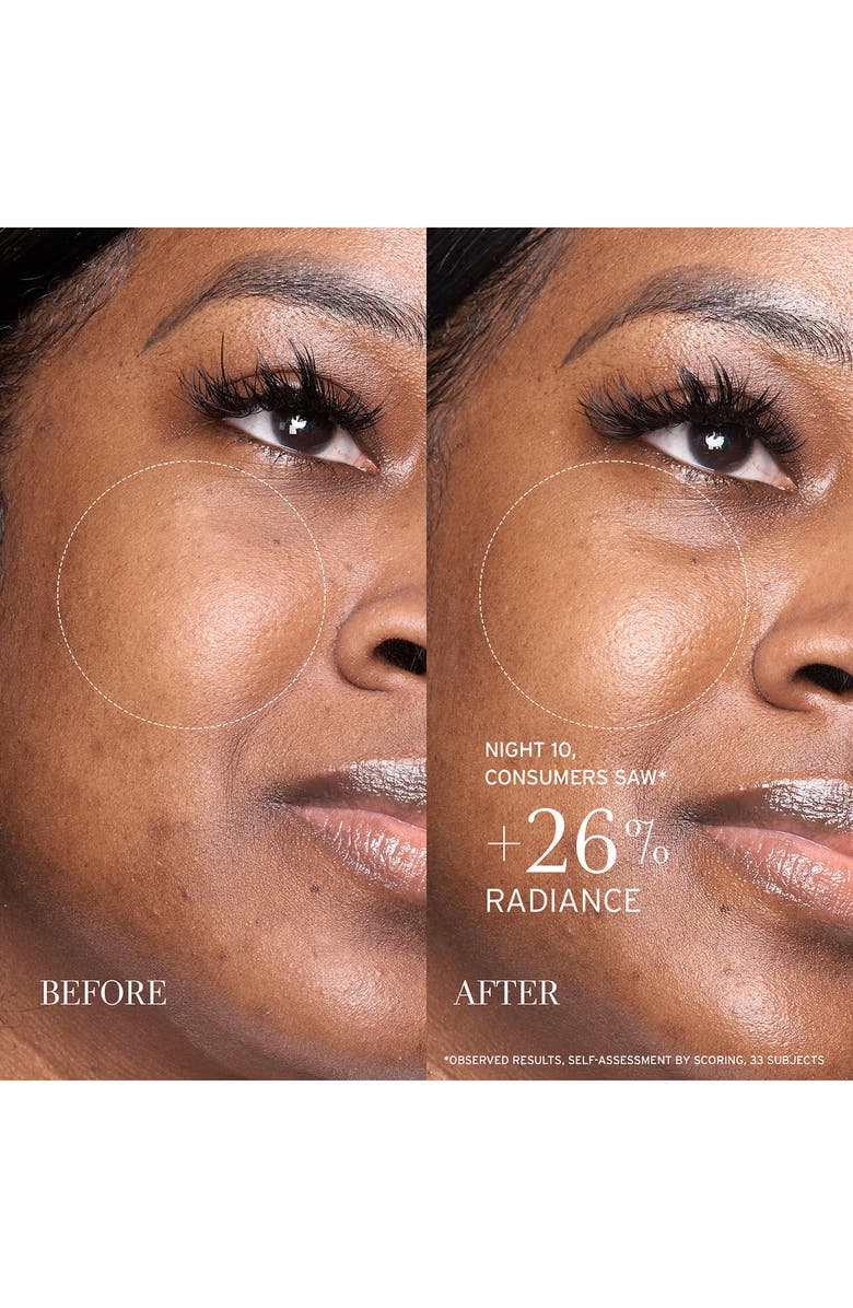 Fresh<sup>®</sup> Lotus Youth Preserve Resurfacing Night Serum, Alternate, color, 