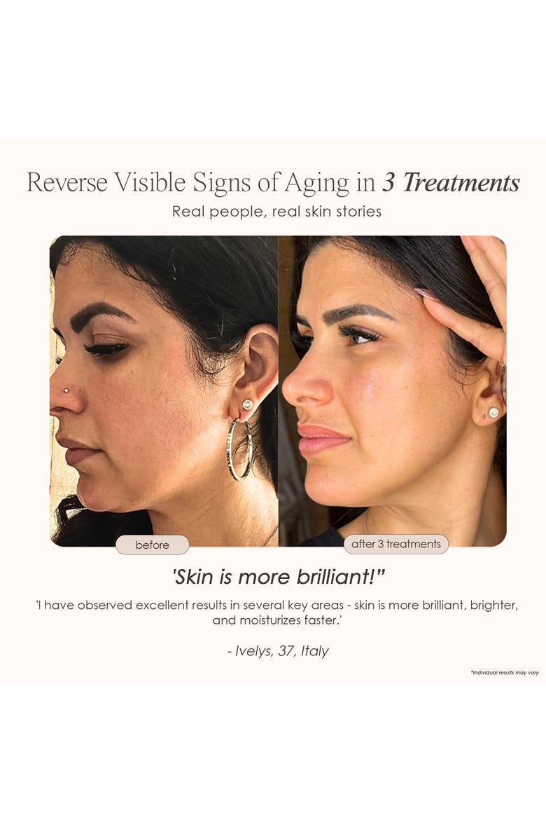 REVA Instant Age Renewal Wand, Alternate, color, White