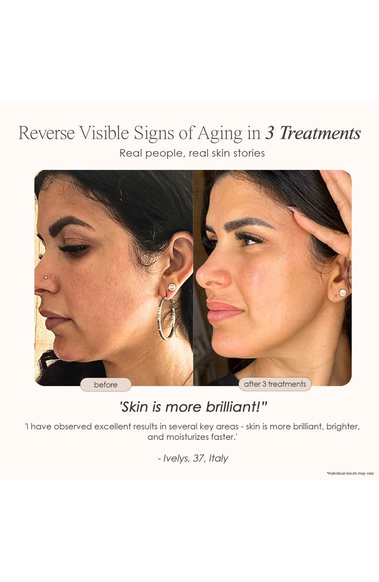 Project E Beauty REVA Instant Age Renewal Wand, Alternate, color, White