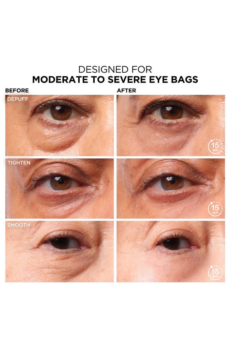 Bye Bye Under Eye Bags Daytime Treatment, Alternate, color, NO COLOR