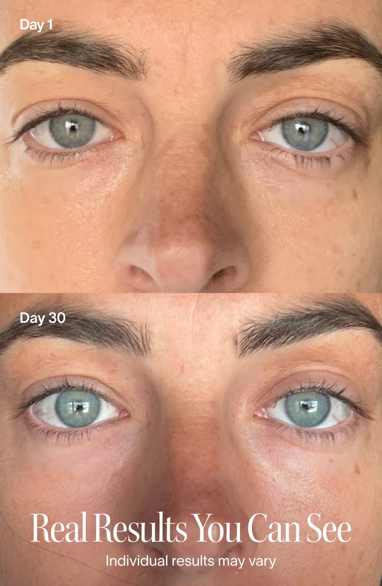 SolaWave Eye Recovery Pro LED Light Therapy Eye Mask, Alternate, color, Pink