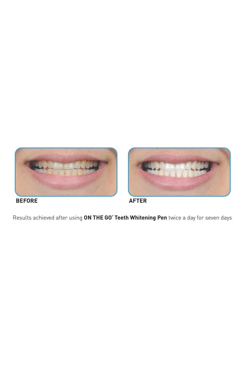 'On the Go®' Teeth Whitening Pen, Alternate, color, NO COLOR