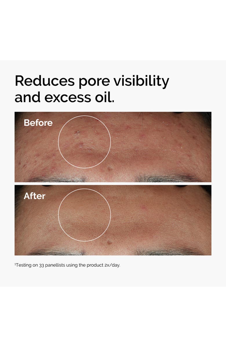 Niacinamide 10% + Zinc 1% Oil Control Serum