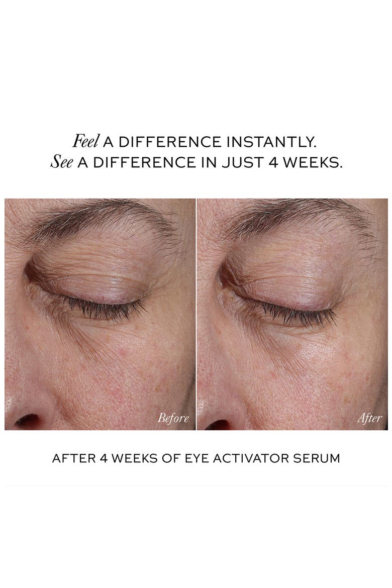 The Activator Serum Duo for Face & Eye $270 Value, Alternate, color, NO COLOR